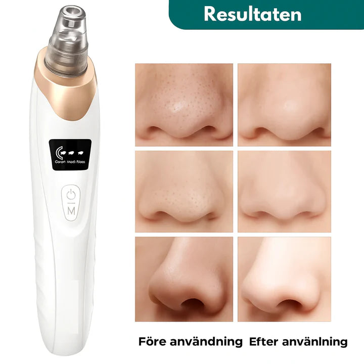 PorFix - För en renare hud utan pormaskar