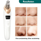 PorFix - För en renare hud utan pormaskar